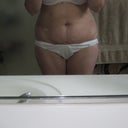 1 day before surgery