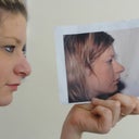 Before and After photo
