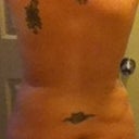 Back 8 weeks post surgery