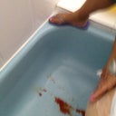 This is another gross pic but up close of what draining your back means
