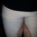 At home after lipo. It's the tumescent fluid that leaking out. I leaked for a day.