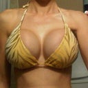 2-26-12, 3 weeks post pocket suturing, 700 hp filled to 850cc's