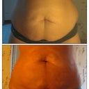 pre and 2 week post