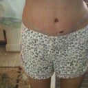 swollen ~ day 9...will post more once swelling goes down