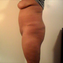 Left side