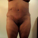 Frontal