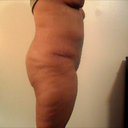 Right side