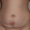 Front pre-op. (rash is from allergies)