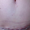 POD 17: The belly button. I tried some of that paint on silicone stuff, which I don't like at all. That's the flaking white stuff. I am going to buy sheets, which I was trying to avoid due to expense.