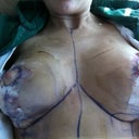just got home from hospital