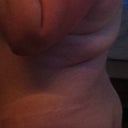 Before - lumps of fat at the bra line is what bothered me the most.  You can see a faint scar on my hips from a previous surgery