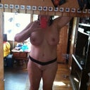Two months post-op. I'm thrilled!