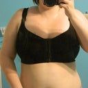 2 days post op