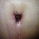 Belly button