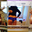middle is before sx, left and right are after second surgery (touchup)..looks great now but will probably shrink!