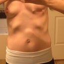 Right before surgery. You can see where the shell is poking me all the time. It's as comfortable as it looks;)