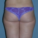 before back thighs