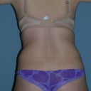 before rear