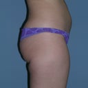 before side