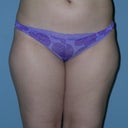 before front