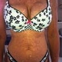 This photo was taken wearing a bra I wore before the mastectomy. It fits perfect now, as well.