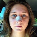 swollen bridge!...my eyebrow looks like its missing haha! its there