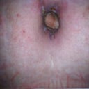 Here is my belley button looking alot better