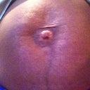 Front View of my stomach