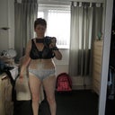 4 days post op.