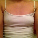 Shirt on front view day b4 surgery