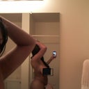 side stomach 5 wks post op