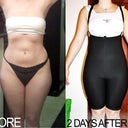 Before and 2 Days After - Front