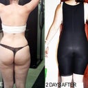 Before and 2 Days After - Back