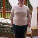The day before surgery