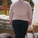 The day before surgery