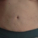 6 weeks post