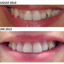 August 2010 - June 2012