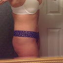 7 wks PO & I feel great