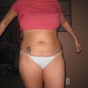 Before Front
