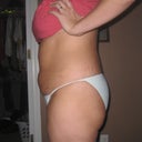 Before Side View