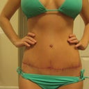 8 weeks PO