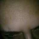 april - still can move my eyebrows together...:(