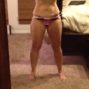 bottom 1/2 pre TT and lateral thigh lipo