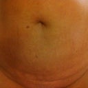 before of my tummy. The blobb .....I mean, I work out, TRY to eat helthy, but this never went away!