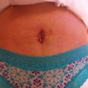 Still some puffiness and two bandages from drains. BUT, I have a flat tummy! OMG