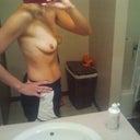1 day before my BA. right side