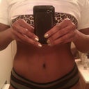 3 months post op