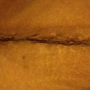 11 days scar. Doc says no treatment for at least 1 month.
