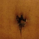 Belly button 11 days. Says to clean with soap and water only.