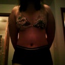 3 weeks post op